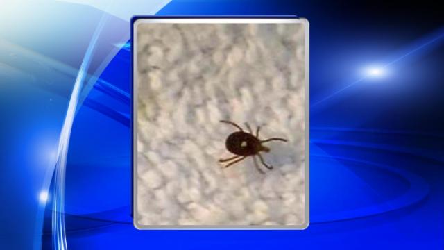 Tick bite leads to food allergy for Durham woman