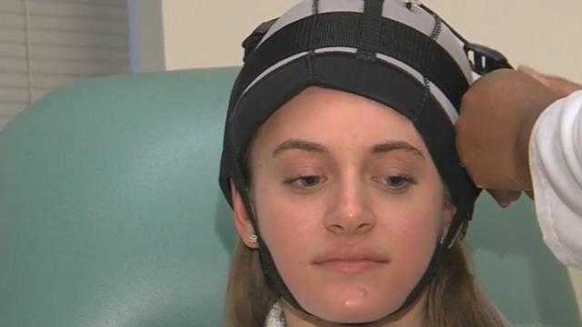Cooling cap could stop women's hair loss during chemotherapy