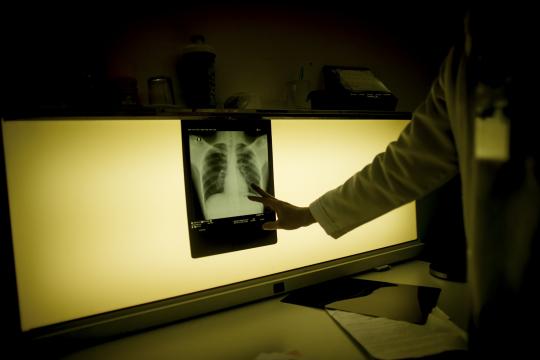 Fast, Cheap Testing for Tuberculosis? Soon It May Be Possible