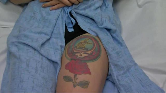 New tattoo removal laser 'feels like a heated cheese grater'