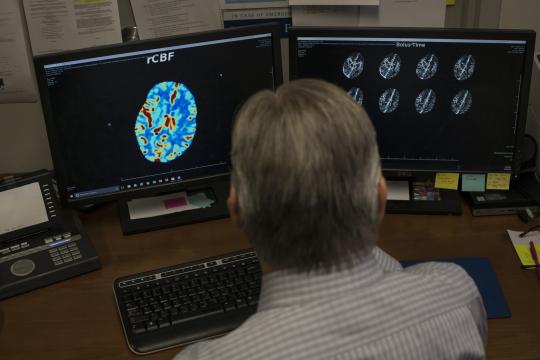 A Stroke Treatment Mired in Controversy