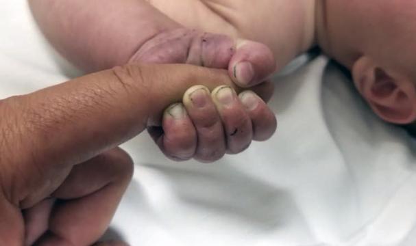 Baby Survives 9 Hours Buried Alive in Montana Woods