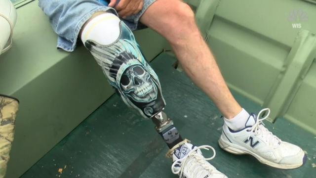 Man offers $3,000 to find missing prosthetic leg in lake