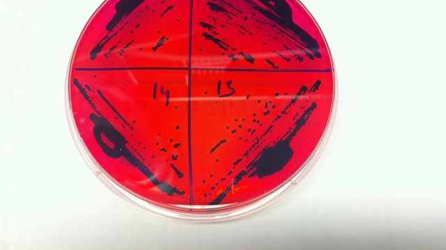 NCSU scientists find antibiotic resistant Salmonella; new outbreak hits 62 people in US