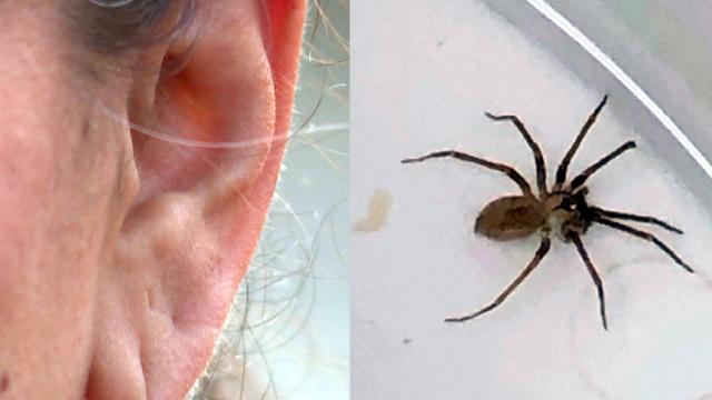 Brown recluse spider found in woman's ear