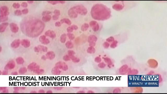 Possible case of bacterial meningitis reported at Methodist University in Fayetteville
