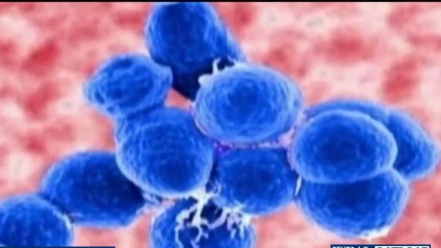 Cumberland health officials work to keep meningitis in check