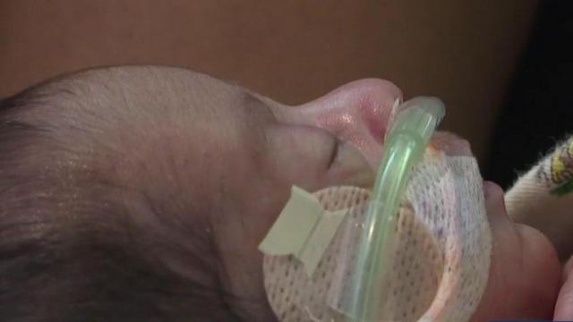 Missouri hospital welcomes 12 sets of twins to world in one week