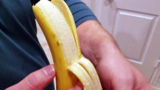 Whiter teeth? Less acne? Sounds like bananas but could be a-peel-ing