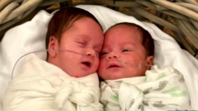Parents can't see twin babies in NICU due to coronavirus
