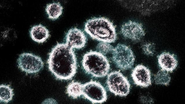 How the Coronavirus Short-Circuits the Immune System