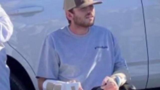 21-year-old trucker home from hospital after losing leg, breaking both arms