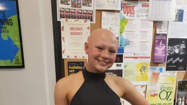 'They don't see the tears:' Mom of child with alopecia says Will Smith's raw emotion understandable 