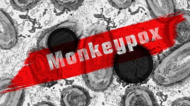 Raleigh-based MAKO Medical, Thermo Fisher Scientific team up for monkeypox battle