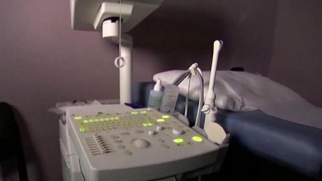 Doctors say abortion ban has unclear exception clause for medical emergencies