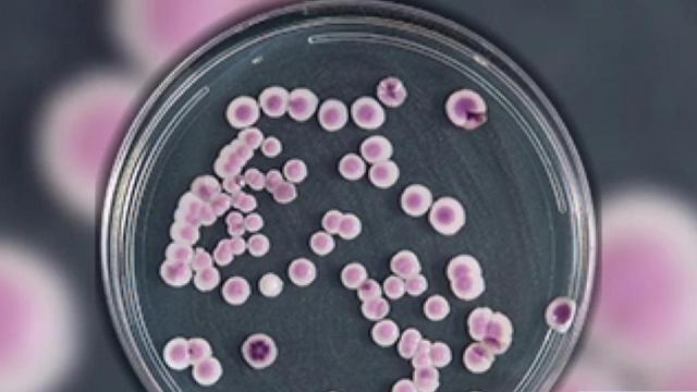 Drug-resistant fungus found in NC