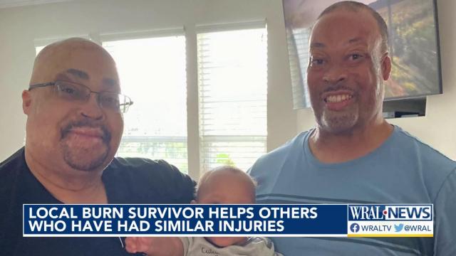 Christopher White recalls propane tank explosion that changed his life