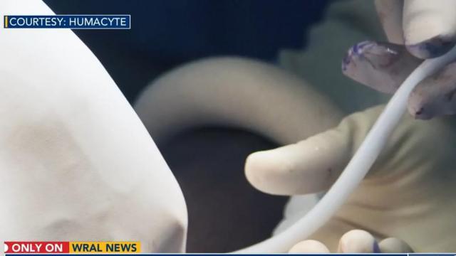 Durham company growing blood vessels from human cells