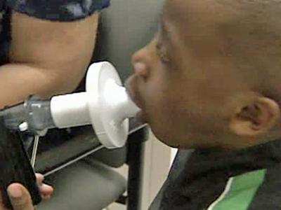 Duke Studies Asthma, Acid Reflux Link in Kids