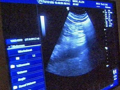 Ultrasound helping to prevent kidney failure