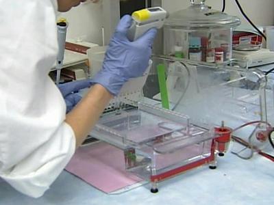 DNA being used to tailor breast cancer treatment