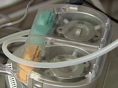 'Liver machine' can help transplant patients in need