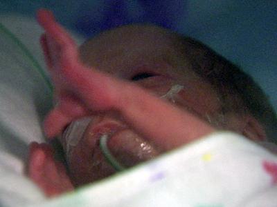 Device checks infant's eyes