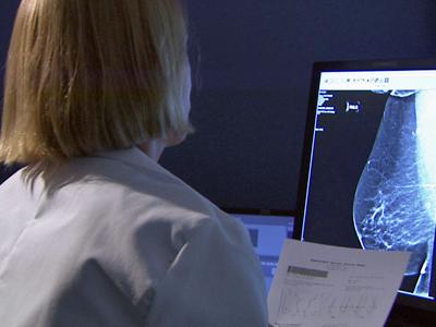 Duke Medicine: Who needs a mammogram?