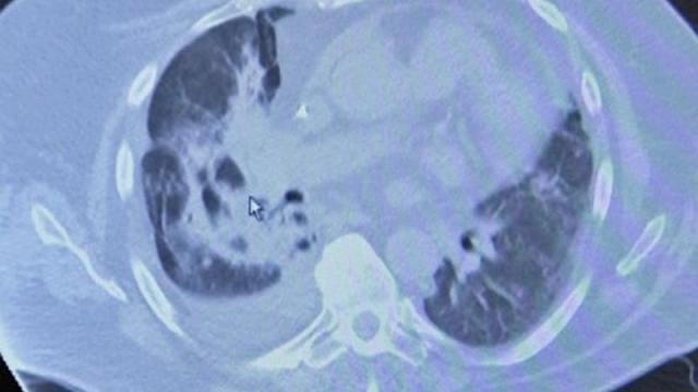 NC ranks 11th in the country for lung cancer, Johnston County ranks 6th 