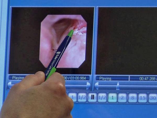 Laser treatment offers hope for vocal chords