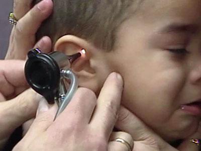Child ear infections can get antibiotics sometimes