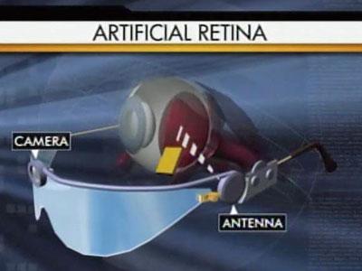 Artificial retina gives sight to the blind